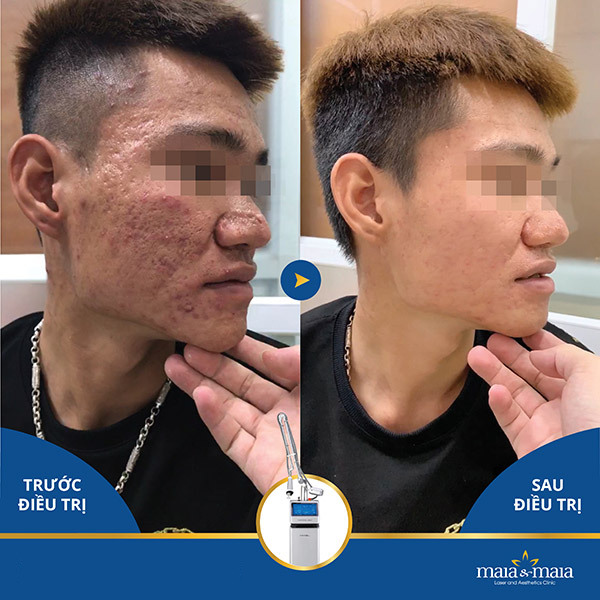 Khách hàng Nguyễn Minh Tiến Khách hàng Nguyễn Minh Tiến