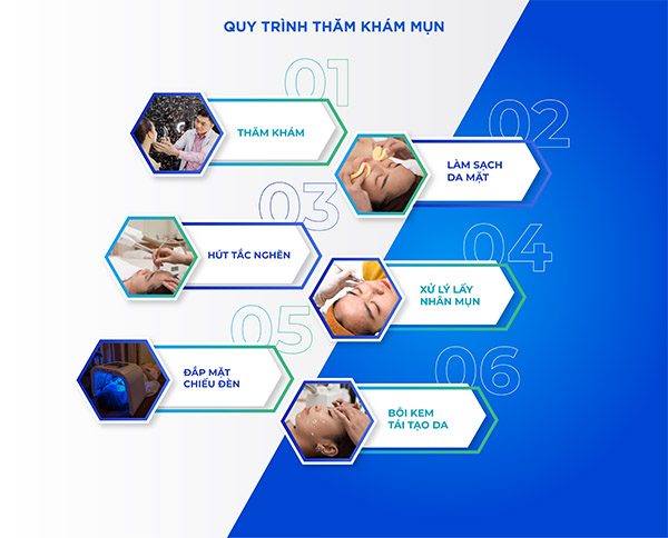 Quy trình hỗ trợ điều trị mụn tại phòng khám Maia Quy trình hỗ trợ điều trị mụn tại phòng khám Maia