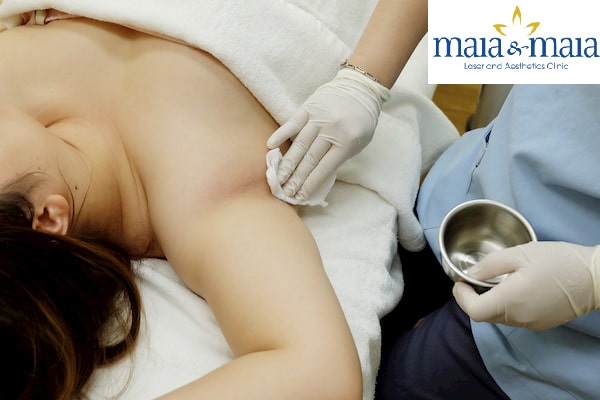Điều trị Hôi nách tại PK Maia&Maia Điều trị Hôi nách tại PK Maia&Maia