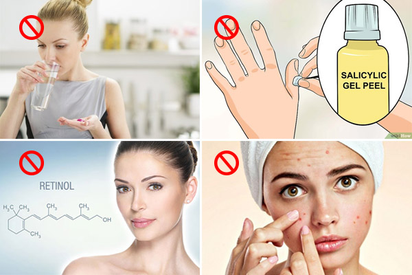 Bị mụn trứng cá khi mang bầu không nên làm gì? Bị mụn trứng cá khi mang bầu không nên làm gì?