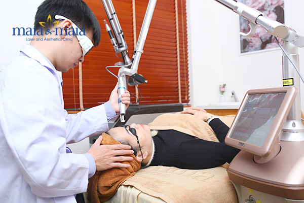 Bác sĩ hỗ trợ điều trị bớt sắc tố cho khách hàng Bác sĩ hỗ trợ điều trị bớt sắc tố cho khách hàng