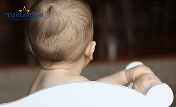 Hiện tượng rụng tóc ở trẻ sơ sinh hoàn toàn bình thường Hiện tượng rụng tóc ở trẻ sơ sinh hoàn toàn bình thường