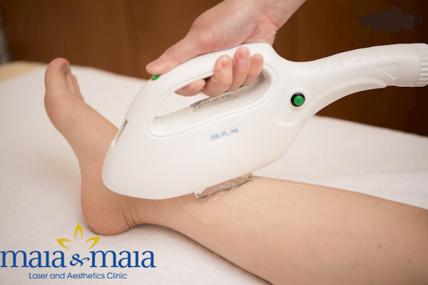 Triệt lông vĩnh viễn có bị mọc lại không? Triệt lông vĩnh viễn có bị mọc lại không?