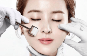 Lăn kim trị nám Lăn kim trị nám
