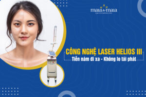 Công nghệ Laser Helios III