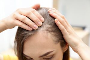 Tùy theo nguyên nhân rung tóc mà có các biện pháp điều trị khác nhau