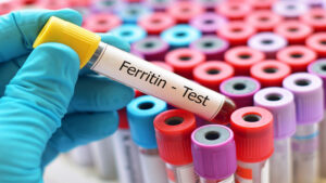 Lượng sắt trong máu được thể hiện qua nồng độ Ferritin