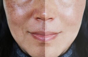 Tia UV là sát thủ vô hình cho làn da