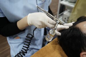 Ngoài PRP, có thể sử dụng nhiều phương pháp khác như Meso đang được áp dụng tại phòng khám Maia