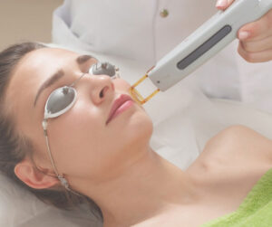Có thể laser để trị nám da trong thời kỳ mang thai những cần cẩn trọng