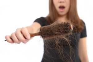 Hãy phân biệt rụng tóc bệnh lý và tóc mỏng