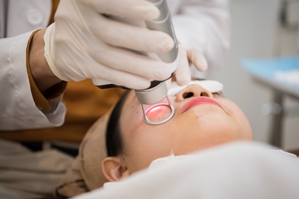 Laser vi điểm là một trong những phương pháp điều trị sẹo rỗ phổ biến nhất