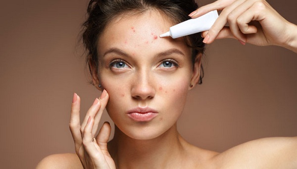 Hãy chăm sóc da mụn đúng cách để ngăn ngừa sự hình thành sẹo rỗ