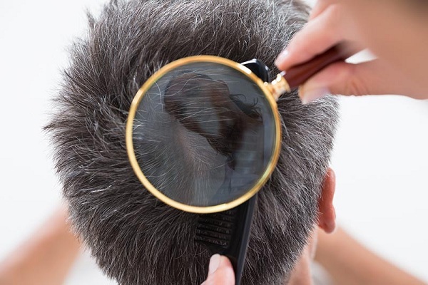 Tạo kiểu nhiều khiến tóc bị tổn thương và rụng dần