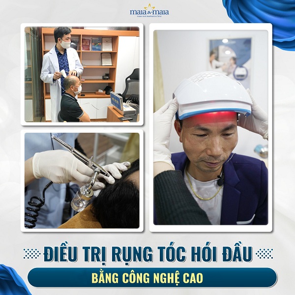 Điều trị rụng tóc bằng công nghệ cao tại phòng khám Maia
