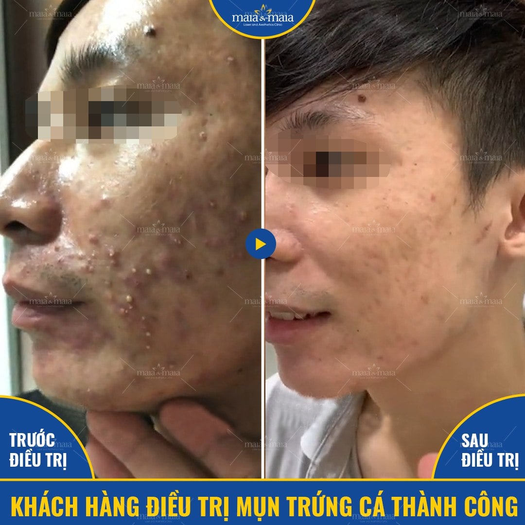 Khách hàng Trần Tuấn Anh Khách hàng Trần Tuấn Anh