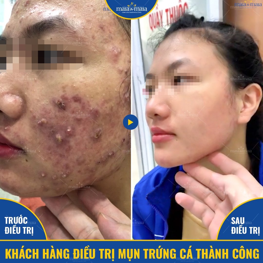 Khách hàng Nguyễn Thu Phương Khách hàng Nguyễn Thu Phương