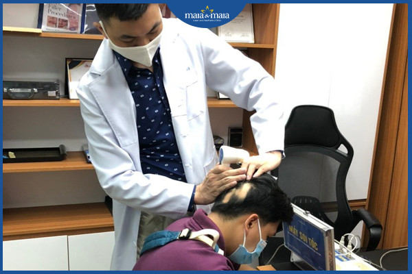 Chứng rụng tóc từng mảng ở nam giới
