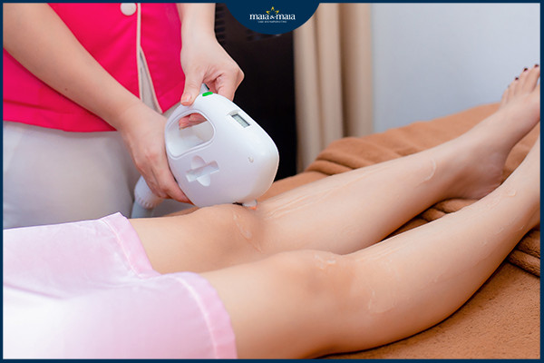 Sử dụng ánh sáng IPL trong triệt lông thẩm mỹ