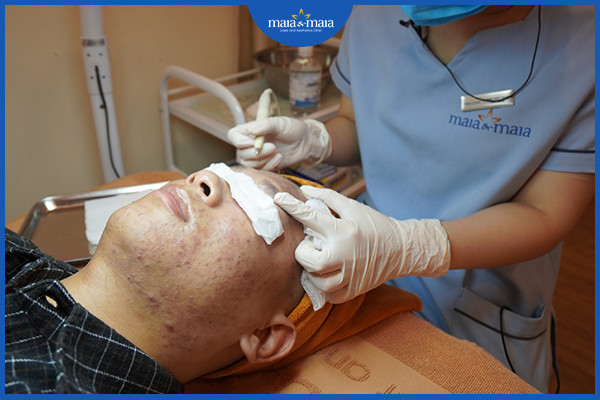 Bạn nên nặn mụn tại theo phương pháp chuẩn y khoa