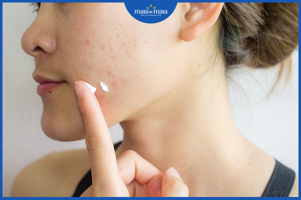 Vitamin E có thể hỗ trợ cải thiện thâm mụn