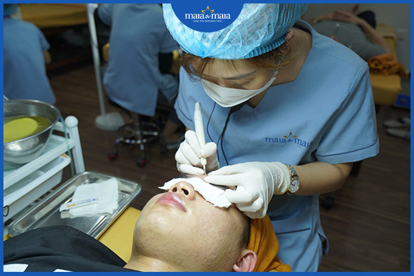 Làm sạch nhân mụn để giải phóng lỗ chân lông