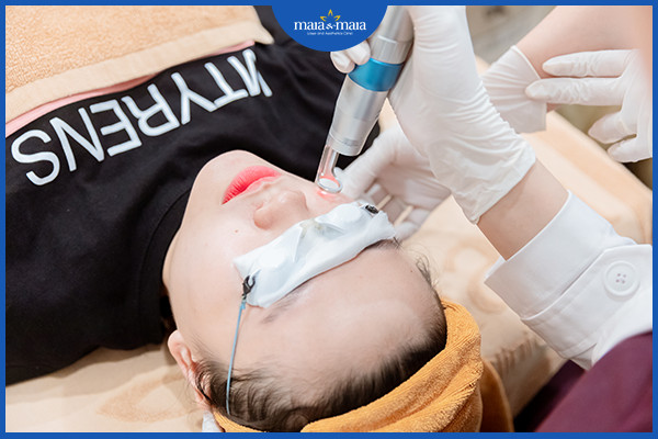 Sử dụng laser giúp điều trị nám hiệu quả quả và an toàn hơn