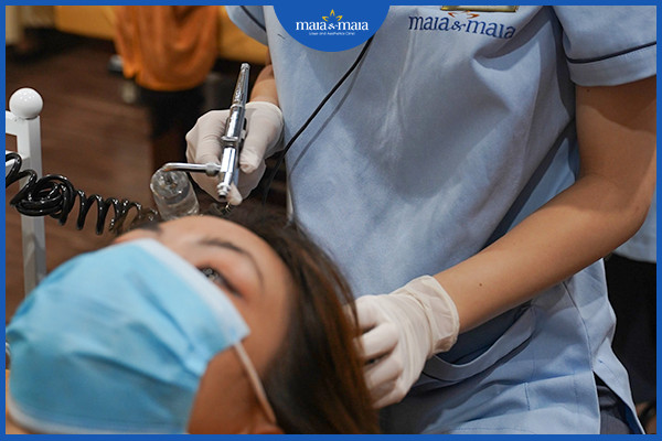 Hỗ trợ điều trị rụng tóc bằng công nghệ cao tại phòng khám Maia