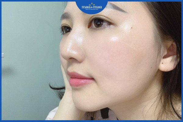 Cải thiện tình trạng da khô bằng cách bổ sung vitamin D