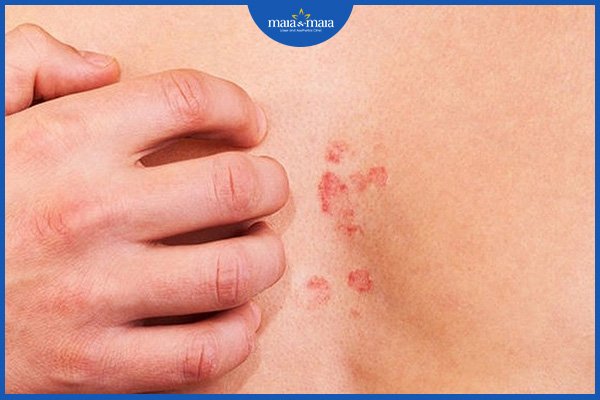 dị ứng thời tiết nên tắm không