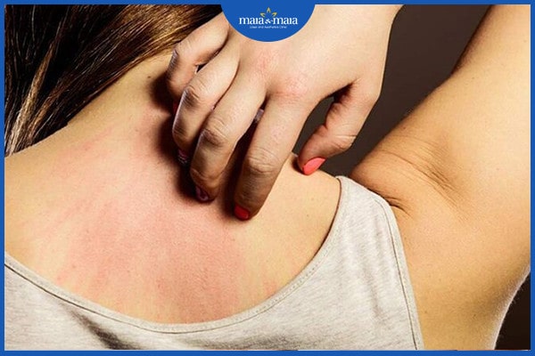 dị ứng thời tiết cần kiêng gì