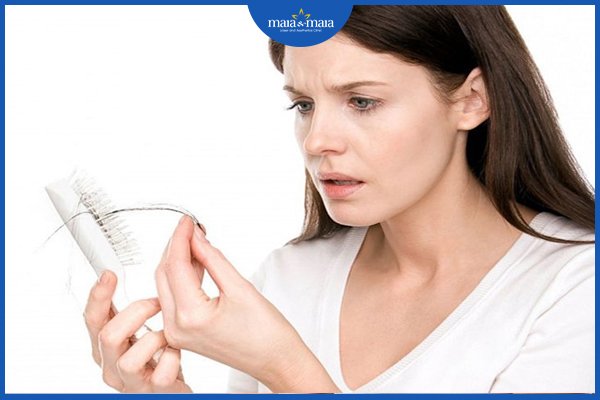 hói đầu và cách điều trị