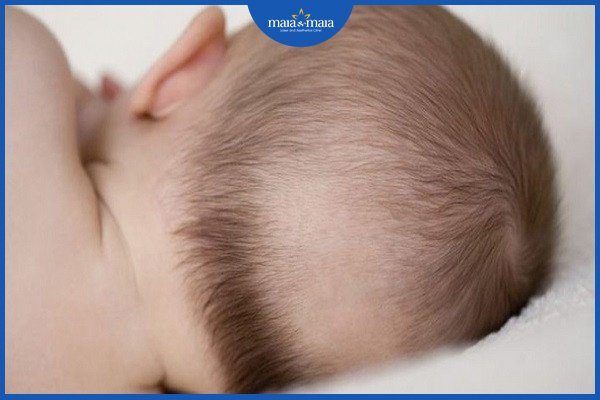 Rụng tóc vành khăn cần bổ sung gì