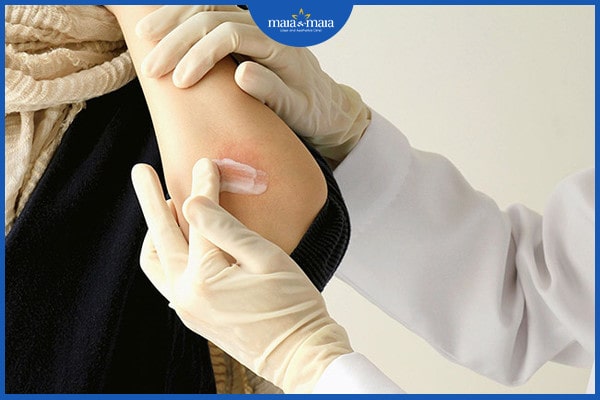 Viêm nang lông bạch cầu ái toan