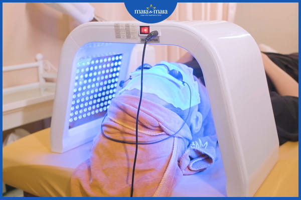 mụn trứng cá mạch lươn