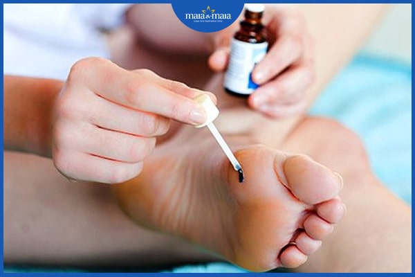 phân biệt mụn cóc và sùi mào gà