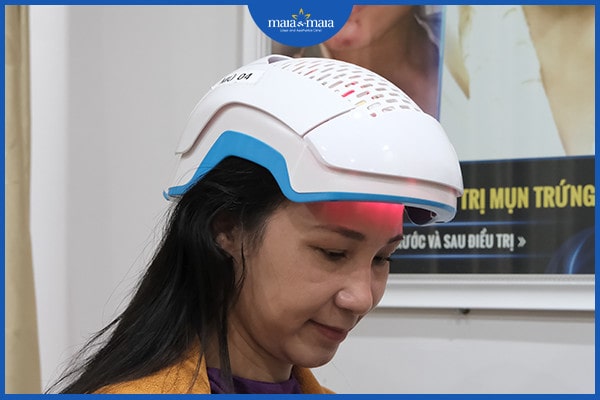 Viêm nang lông da đầu có lây không
