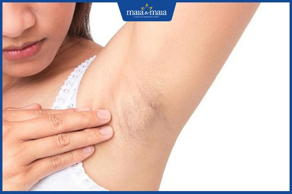 Có bầu dùng lăn khử mùi được không