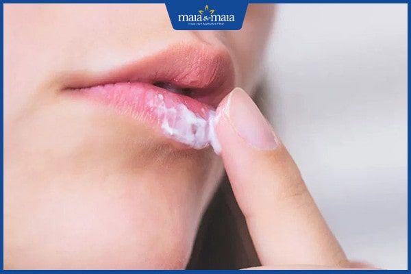 điều trị viêm môi