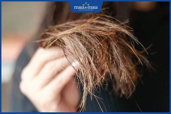vấn đề thường gặp ở tóc